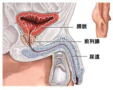 射精障碍需要怎样预防？