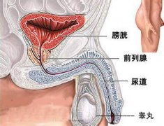 膀胱炎的症状详解