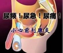 不要忽视小腹胀痛