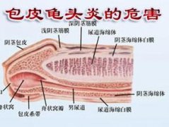 细数龟头炎的病因