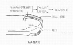 阴茎起小疙瘩是怎么回事