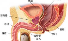 前列腺炎的危害有哪些?